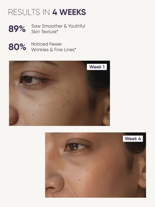 Milau night cream before after results smoother skin texture reduced wrinkles 4 weeks skincare India